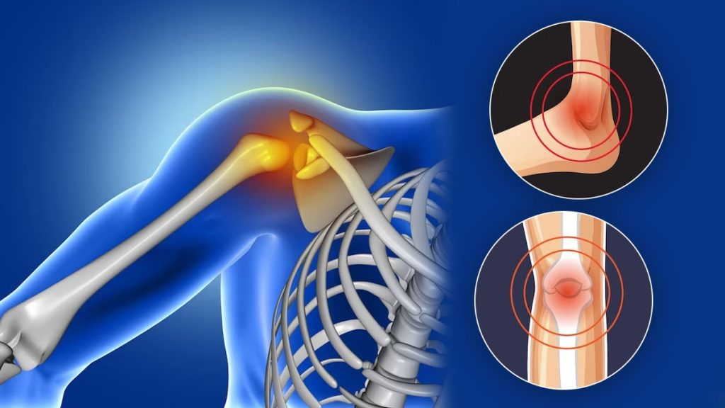 Vitamin D: உடலில் வைட்டமின் டி குறைந்தால் என்ன ஆகும்?